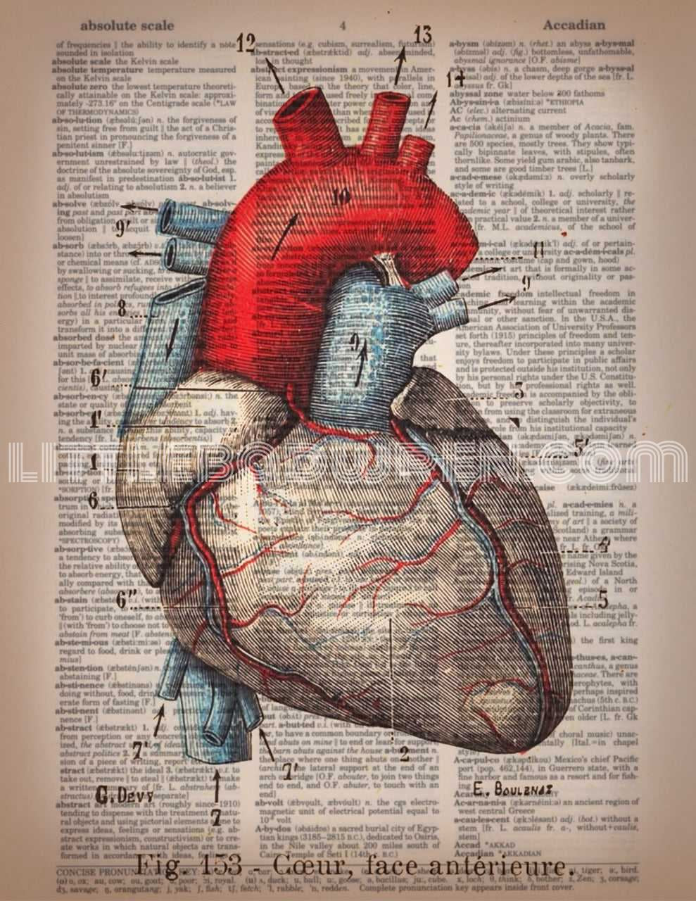 Heart - Pulmonary image 0